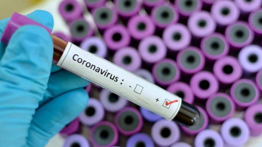 Prefeitura anunciou a compra de 40 mil testes para diagnóstico de covid-19